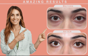 Derm Le Veux Anti-Aging Serum