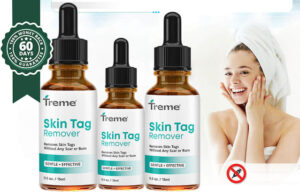 Treme' Skin Tag Remover